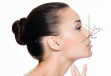 Nâng mũi tạo hình S line – TS BS Lê Tấn Hùng