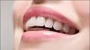 Tái tạo nụ cười thẩm mỹ – TS BS Lê Tấn Hùng