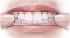 Tẩy trắng răng thẩm mỹ – TS BS Lê Tấn Hùng