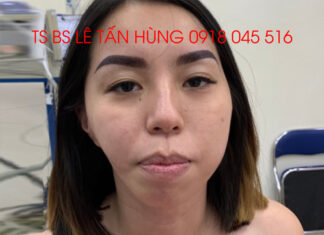 Ghép xương tạo hình xương hàm – TS BS Lê Tấn Hùng