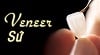 Dán răng sứ veneers – TS BS Lê Tấn Hùng