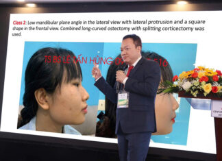 Công bố nghiên cứu “Phân loại và điều trị khuôn mặt vuông” – TS BS Lê Tấn Hùng